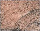 Inlac Pink